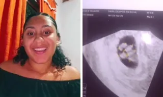 Imagem ilustrativa da imagem Jovem descobre que está grávida de quíntuplos e chega a passar mal em ultrassom