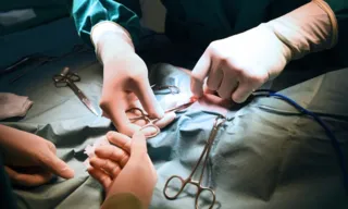 Imagem ilustrativa da imagem Mulher descobre pinça esquecida em cirurgia ao ser barrada em detector de metais
