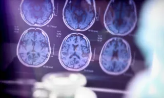 Imagem ilustrativa da imagem Descobertas sobre o Alzheimer dão mais esperança a pacientes
