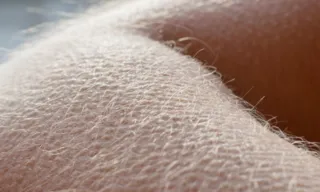 Imagem ilustrativa da imagem Nossa envolvente pele