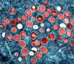 Imagem ilustrativa da imagem OMS alerta para variante mais perigosa de mpox (monkeypox)