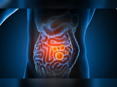 Imagem ilustrativa da imagem Incidência de doenças inflamatórias intestinais sobe 233% em 8 anos no Brasil