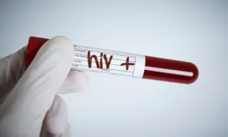 Imagem ilustrativa da imagem Nova variante do HIV está circulando em pelo menos três estados brasileiros