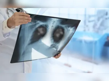 Imagem ilustrativa da imagem Pneumonia: hospitais têm alta de casos, incluindo tipo "silencioso". Veja sintomas