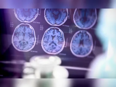 Imagem ilustrativa da imagem Ser otimista pode ser uma forma de proteção contra o Alzheimer, diz estudo