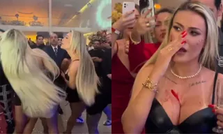 Imagem ilustrativa da imagem Andressa Urach cospe em Juju Ferrari e sai de festa com corte no rosto