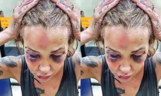 Imagem ilustrativa da imagem Justiça condena ex-namorado de jornalista por tentativa de feminicídio