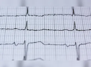 Imagem ilustrativa da imagem Aparelho que faz eletrocardiograma doméstico chega às farmácias do País