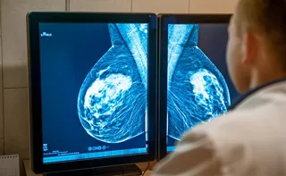 Imagem ilustrativa da imagem Senado aprova projetos que antecipam idade mínima para mamografia no SUS