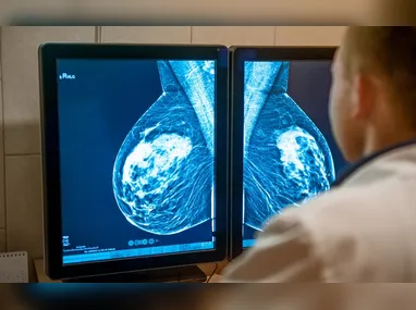Imagem ilustrativa da imagem Senado aprova projetos que antecipam idade mínima para mamografia no SUS