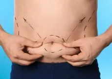 Aumenta a procura por Lipoaspiração Ultra HD - homens tem liderado o ranking na procura pelo procedimento.