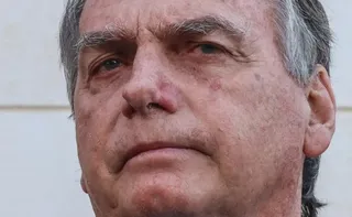 Imagem ilustrativa da imagem Equipe médica de Bolsonaro descarta complicações pós-cirúrgicas
