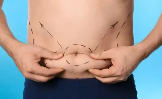 Imagem ilustrativa da imagem Lipo UltraHD: conheça a cirurgia para quem busca “barriga de tanquinho”