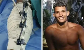 Imagem ilustrativa da imagem “Qual a dúvida de quem é a vítima?”, diz mãe de ambulante baleado por delegado