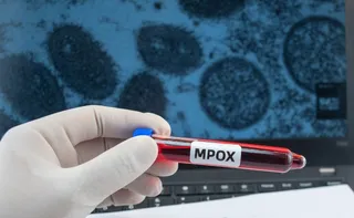 Imagem ilustrativa da imagem Região Norte do Brasil registra casos de mpox