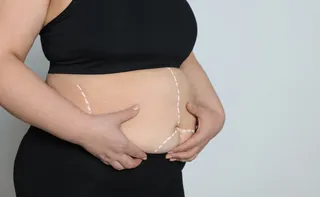 Imagem ilustrativa da imagem Após novas regras, mais jovens buscam por cirurgia bariátrica