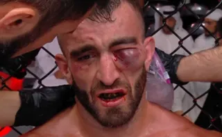 Imagem ilustrativa da imagem Lutador fica com olho inchado após pancadas e causa cena grotesca no UFC; veja