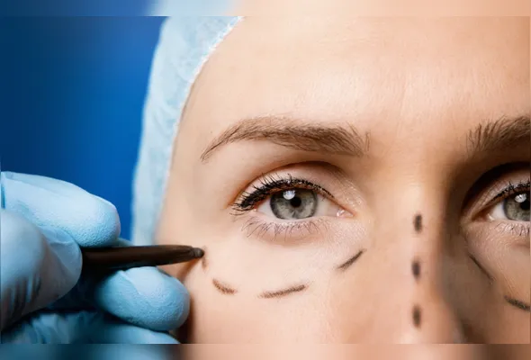 Em busca de rejuvenescimento e contorno facial, cada vez mais pessoas recorrem a cirurgias na face, como lifting, blefaroplastia e neck lift.