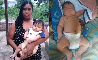 Imagem ilustrativa da imagem “Bebê gigante” de 7 kg nasce de parto normal e mãe leva 51 pontos no ES