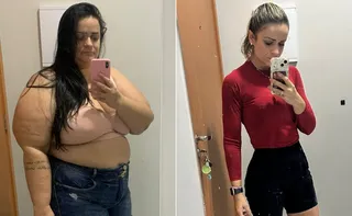 Imagem ilustrativa da imagem Da obesidade ao bem-estar: capixabas relatam mudanças de vida após a bariátrica