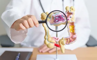 Imagem ilustrativa da imagem Estudo estima que número de mortes por câncer colorretal pode aumentar em 36,3%