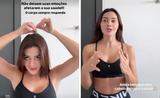 Imagem ilustrativa da imagem Franciny Ehlke revela que perdeu cabelo por estresse e fala sobre alopecia