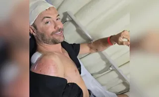 Imagem ilustrativa da imagem Após atropelamento grave em 2023, Kayky Brito se envolve em novo acidente