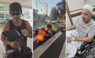 Imagem ilustrativa da imagem Chef de cozinha faz alerta após acidente com moto elétrica: "Usem capacete"