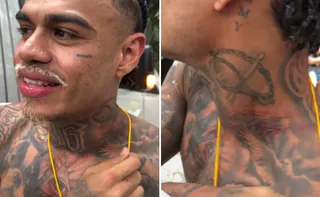 Imagem ilustrativa da imagem MC Cabelinho fica com pescoço machucado após tentativa de furto em Salvador