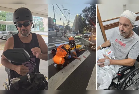 Imagem ilustrativa da imagem Chef de cozinha faz alerta após acidente com moto elétrica: "Usem capacete"