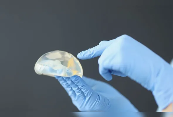 Imagem ilustrativa da imagem Mulheres retiram silicone para recuperar visual natural