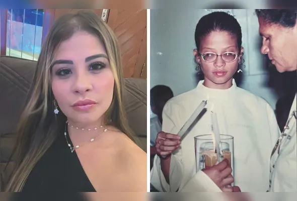 Jaqueline Helena desenvolveu durante a infância miopia degenerativa