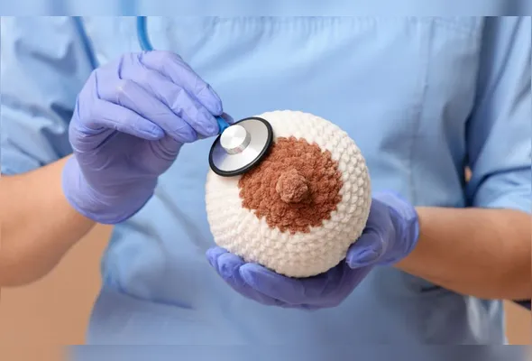 Imagem ilustrativa da imagem Por que o câncer de mama está mais comum em jovens?