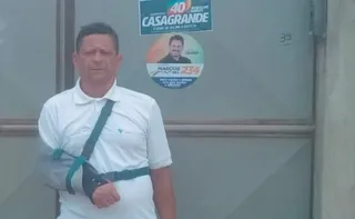 Imagem ilustrativa da imagem "Ainda sinto medo ao olhar para uma moto”, diz ex-motoboy vítima de acidente