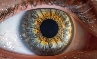 Imagem ilustrativa da imagem Bactéria comum no olho pode estar ligada à piora do Alzheimer, diz estudo