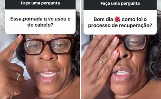 Imagem ilustrativa da imagem Cacau Protásio volta a enxergar após cegueira temporária e faz alerta sobre produto