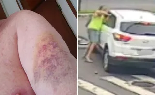 Imagem ilustrativa da imagem Dentista é indiciado após agredir idoso com socos em briga no trânsito em Vitória