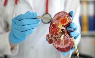 Imagem ilustrativa da imagem Exames gratuitos para detectar problemas nos rins