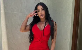 Imagem ilustrativa da imagem Famosos voltam atrás e revertem procedimentos estéticos em busca de naturalidade