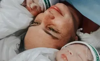 Imagem ilustrativa da imagem Gêmeos nascem empelicados em hospital de Vitória; caso é considerado raro