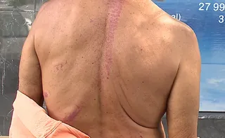 Imagem ilustrativa da imagem Idoso argentino é espancado e roubado na Serra