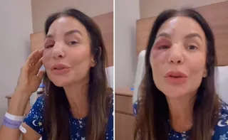 Imagem ilustrativa da imagem Ivete Sangalo ressurge após cirurgia no rosto: 'Poderia ter sido tão pior'