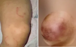 Imagem ilustrativa da imagem Mãe e padrasto são presos suspeitos de agredir bebê com mordidas em Vila Velha