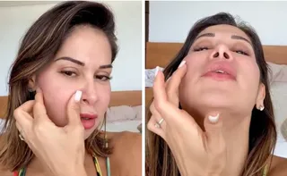 Imagem ilustrativa da imagem Maíra Cardi passará por cirurgia delicada após deformação no rosto