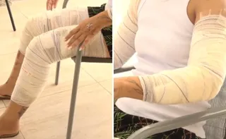 Imagem ilustrativa da imagem Mulher é perseguida e atropelada por ex após sair de bloco de Carnaval na Serra