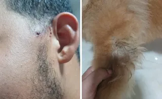 Imagem ilustrativa da imagem Pitbull ataca jovem e chow-chow duas vezes no Perocão, em Guarapari