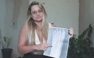 Imagem ilustrativa da imagem Sobreviventes de acidentes com motos lutam contra dores e depressão