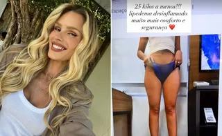 Imagem ilustrativa da imagem Yasmin Brunet revela ter perdido 25 kg em tratamento contra lipedema