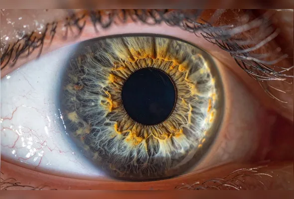 Imagem ilustrativa da imagem Bactéria comum no olho pode estar ligada à piora do Alzheimer, diz estudo