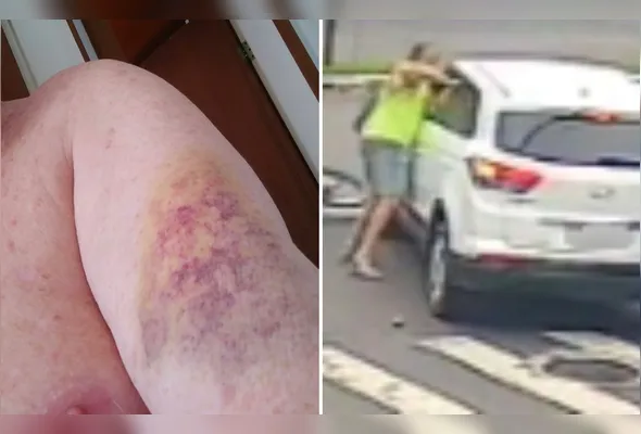 Dentista estava em uma bicicleta quando colidiu com o veículo do idoso